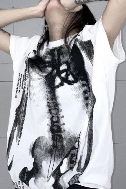 X-Ray Bone Graphic T-Shirt